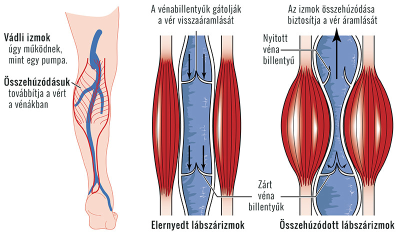 a bal láb tünetei