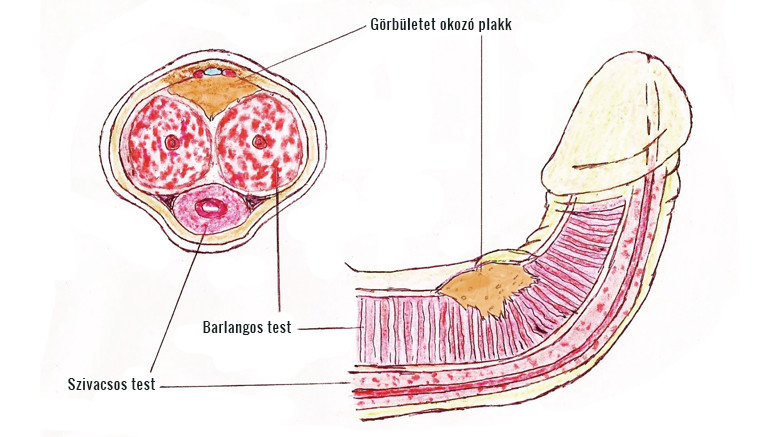Külső genitáliák sérülése | Urológiai Klinika