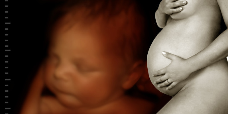 Terhességi visszér: ami a várandósságot valóban „terhessé” teszi - Dr. Zátrok Zsolt blog