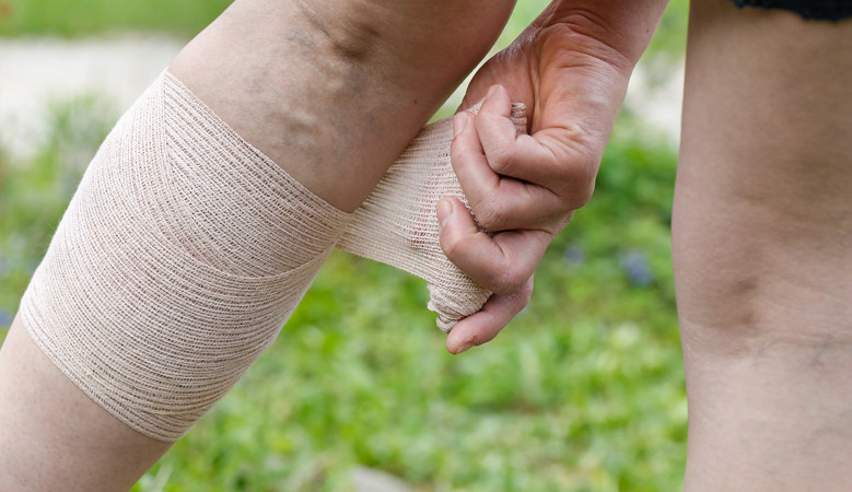 a lábízület fáj, ha séta rheumatoid arthritis fájdalom a kezekben