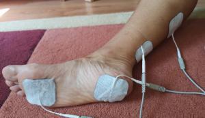 a lábízület periarthritis kezelése