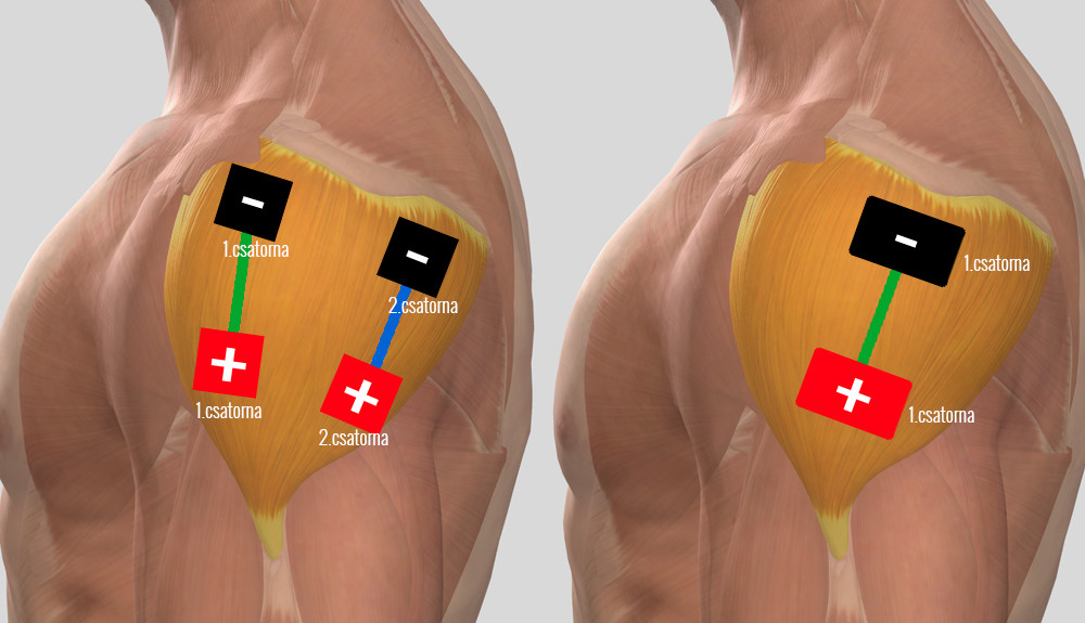 mikoplazmózis és fájdalom a lábak ízületeiben térdízület kezelő tabletták